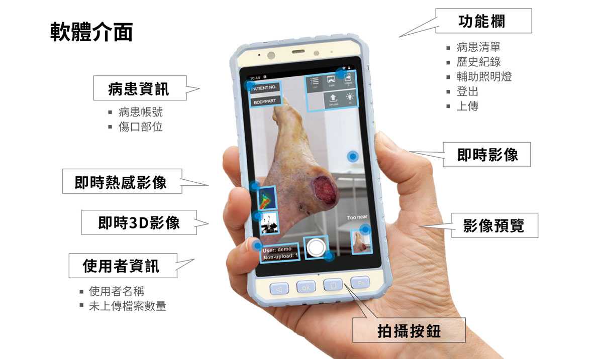 智慧傷口照護機