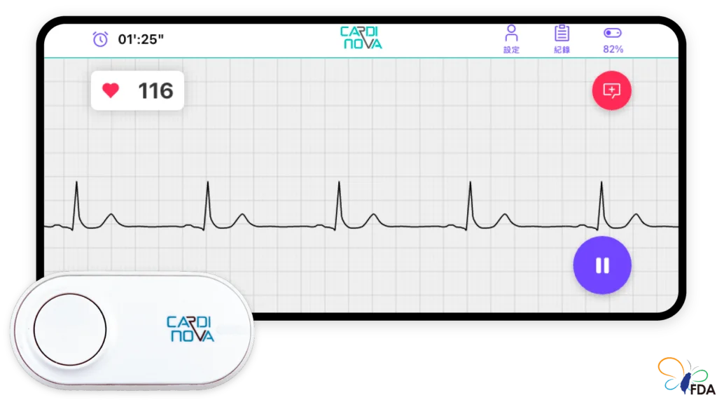卡蒂諾華心電圖紀錄器 CARDINOVA ECG Recorder